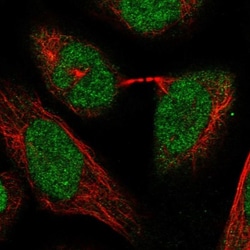 RPC62 Antibody, Novus Biologicals 0.1mL; Unlabeled:Antibodies, Polyclonal